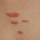 Advanced Scar Removal