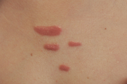 Advanced Scar Removal